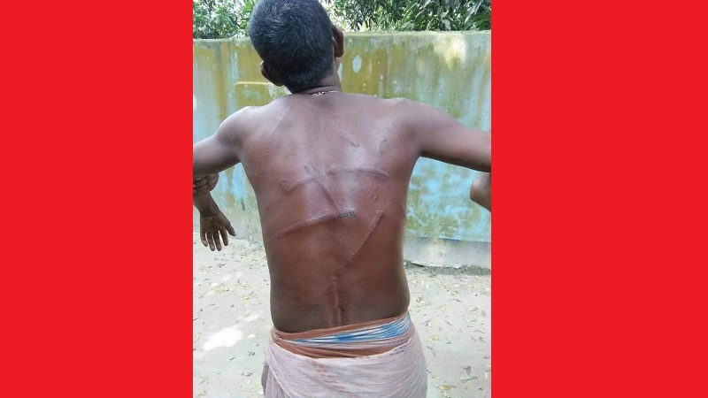 গোবিন্দগঞ্জে টেলিভিশনে সাক্ষাতকার দেওয়ায় সংখ্যালঘু সম্ভু মাঝি সন্ত্রাসী হামলায় আহত