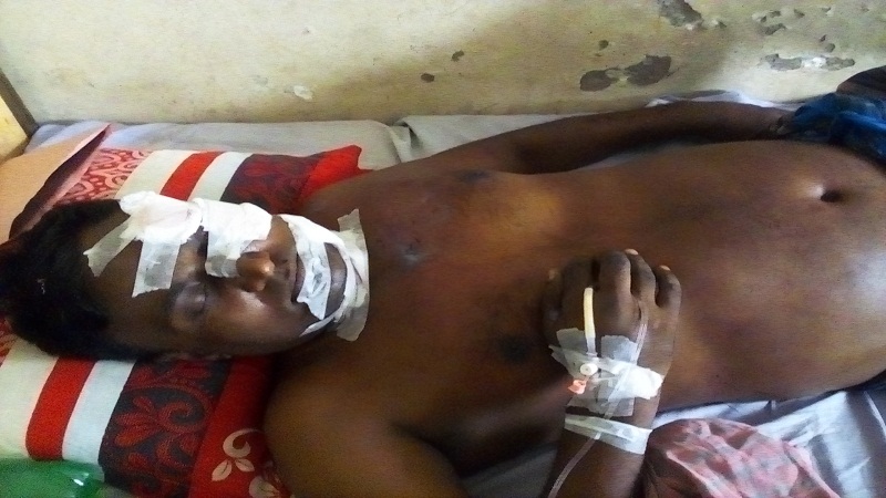 হরিণাকুণ্ডুউপজেলাতে বেড়েই চলেছে সড়ক দুর্ঘটনা ; চলতি মাসে দুর্ঘটনার শিকার ২২, নিহত ২