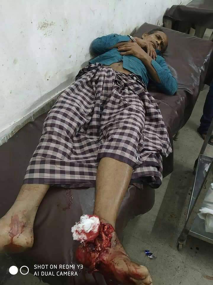 গাইবান্ধায় পুলিশের সাথে বন্দুক যুদ্ধে ২ ডাকাত গুলিবিদ্ধ 