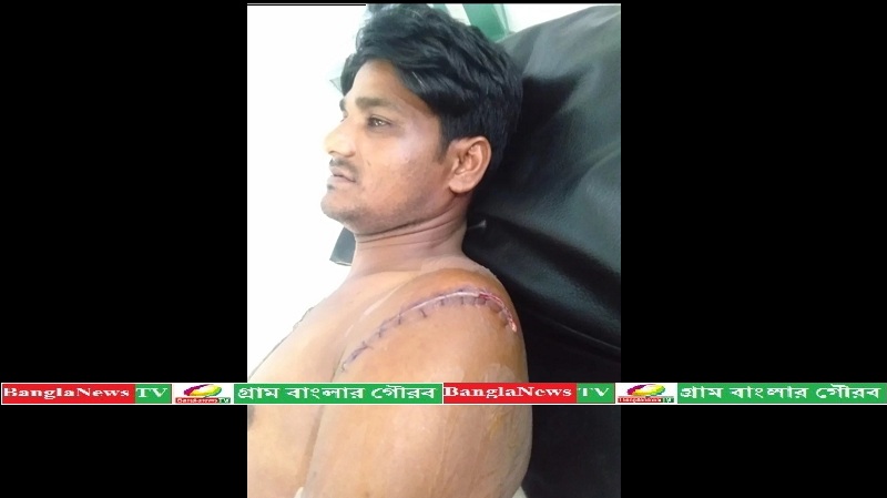 পালংখালীতে স্ত্রী রহিমা খাতুন এর ধারালো দা,র আগাতে মৃত্যুর সজ্জায় স্বামী মোহাম্মদ আরিফ।