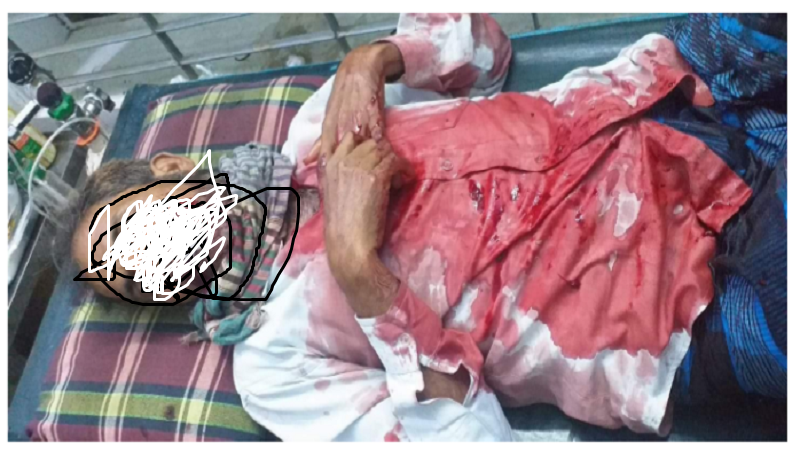 দুর্বৃত্তের হামলার স্বীকার ইউপি সদস্য