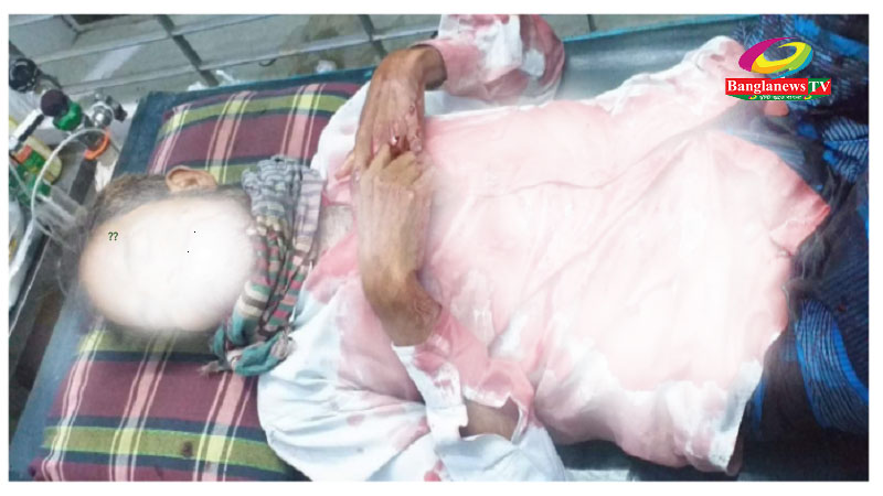 দুর্বৃত্তের হামলার স্বীকার ইউপি সদস্য