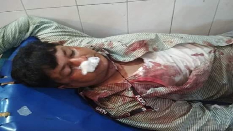 করোনাকালেও যখন সাংবাদিক রক্তাক্ত ক্ষতবিক্ষত