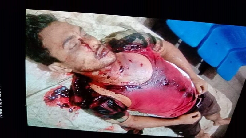 উখিয়ায় বন্দুকযুদ্ধে বালুখালীর ইয়াবা কারবারি জাহাঙ্গীর নিহত,ইয়াবা ও অস্ত্র উদ্ধার