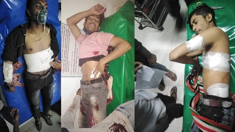 ঝিনাইদহে কিশোর গ্যাং এর ছুরিকাঘাতে নিহত ১ গুরুতর আহত ২