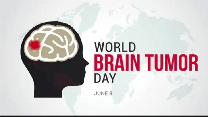 ৮জুন বিশ্ব ব্রেইন টিউমার দিবস : সম্মিলিত প্রচেষ্টায় ব্রেন টিউমারের চিকিৎসা সম্ভব